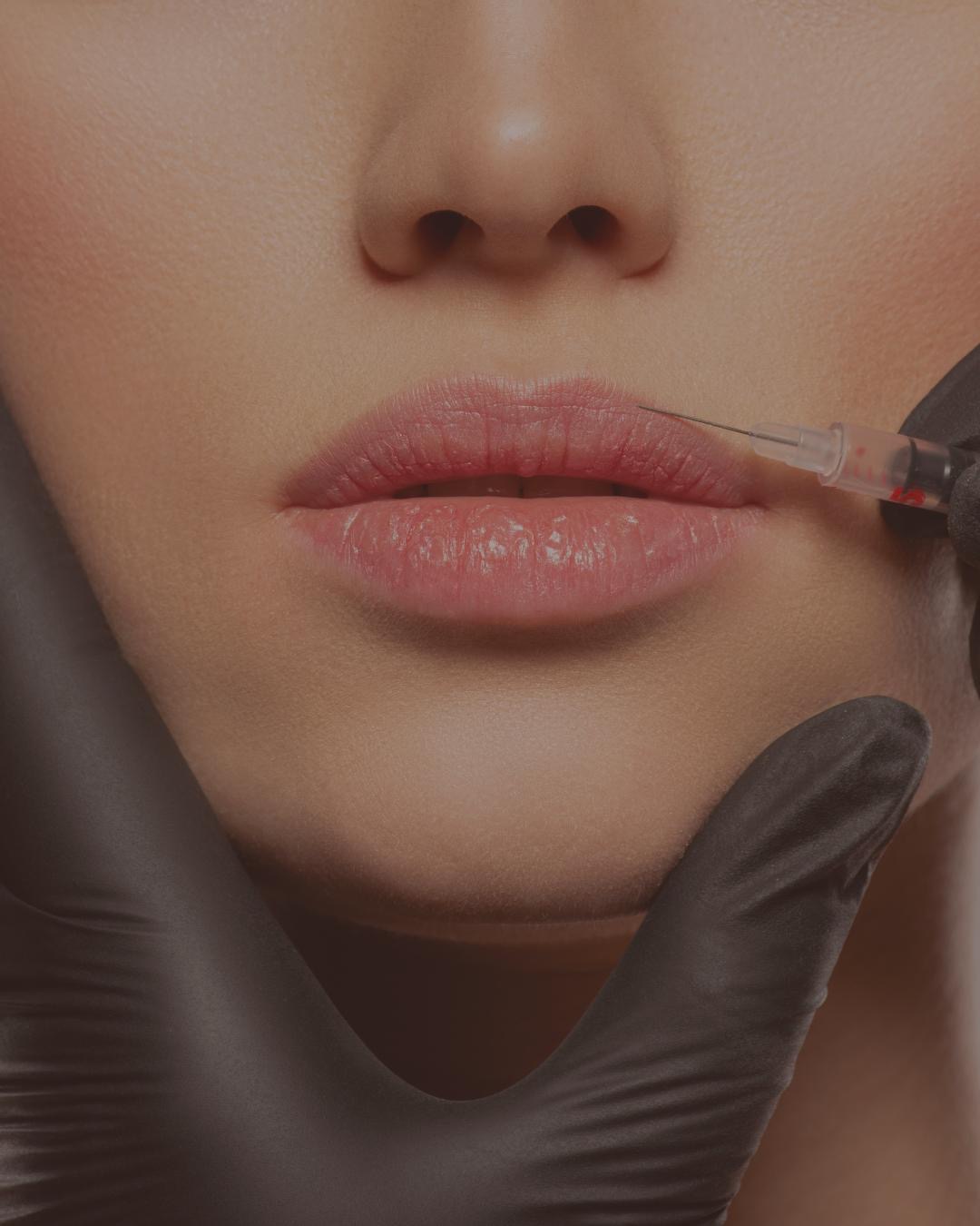 Dermal Fillers
